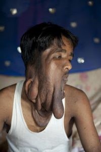 ElephantMan_3