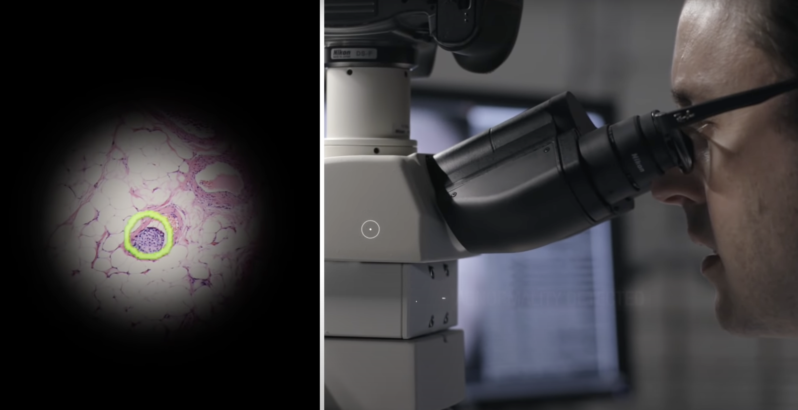 AI 顯微鏡讓癌症原形畢露，Google 與美國國防部合作檢測準確率高達 94%